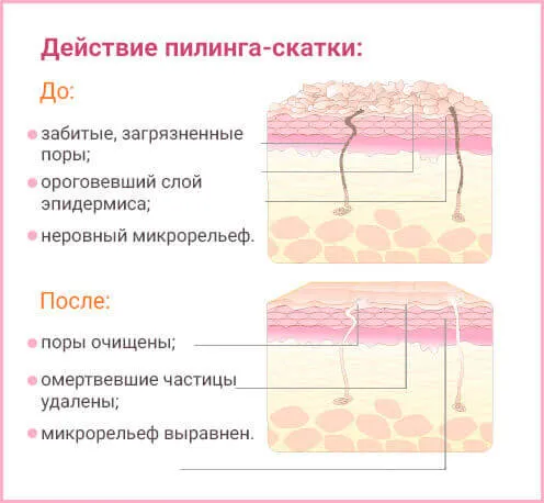 5 важных правил использования пилинг-скатки 20