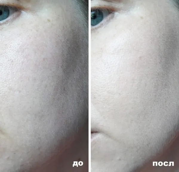 Кожа лица до и после нанесения Lumene CC Color Correcting Cream