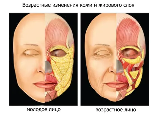 возрастные изменения кожи и жирового слоя