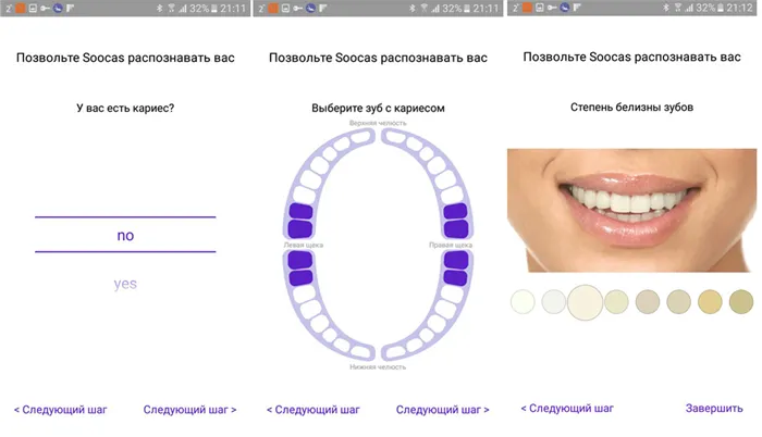 Обзор электрической зубной щетки Xiaomi Soocas Sonic Electric Toothbrush X3U 12